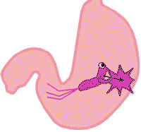 http://7xo6kd.com1.z0.glb.clouddn.com/upload-ueditor-image-20160405-1459859771991085733.gif